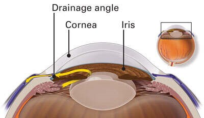 Drainage, angle, cornea, iris