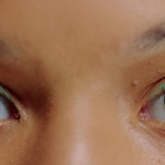 los lentes de contacto de color pueden dañar tus ojos